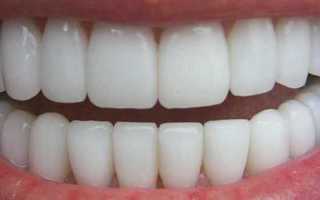 Наращивание зубов – цены на процедуру