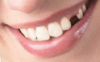 Потеря зубов – с чем связано это явление, и каковы последствия