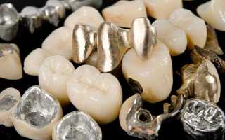 Роль металлов в современной стоматологии и сферы их использования
